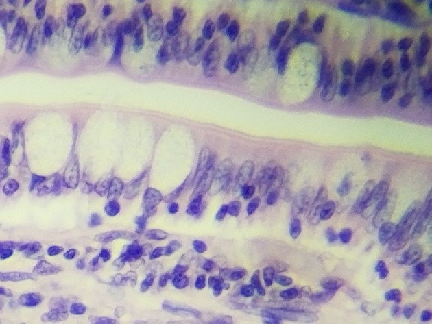 Simple Columnar Epithelium Slides - Simple Columnar Epithelium 15 400X